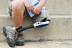 Mann mit Beinprothese, auf einer Treppe sitzend